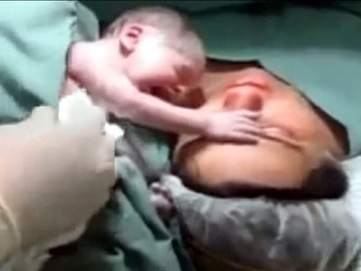 Emocionante! Bebê se “desespera” por ter que sair do lado da mãe após o parto; assista ao vídeo