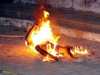 Morre homem queimado por filho após briga por uso de computador