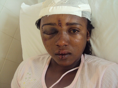 Mulher é vítima de violência doméstica em Rio de Contas