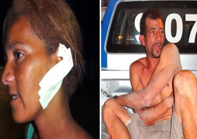 Homem morde, arranca e come orelha da companheira em Itabela