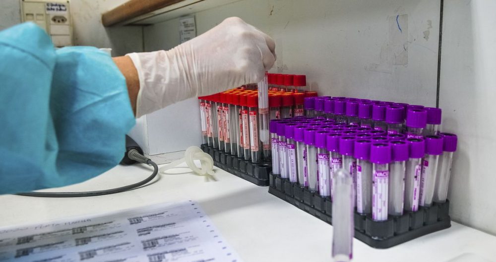 Bahia registra 31 óbitos e 3.206 novos casos de Covid-19 nas últimas 24h