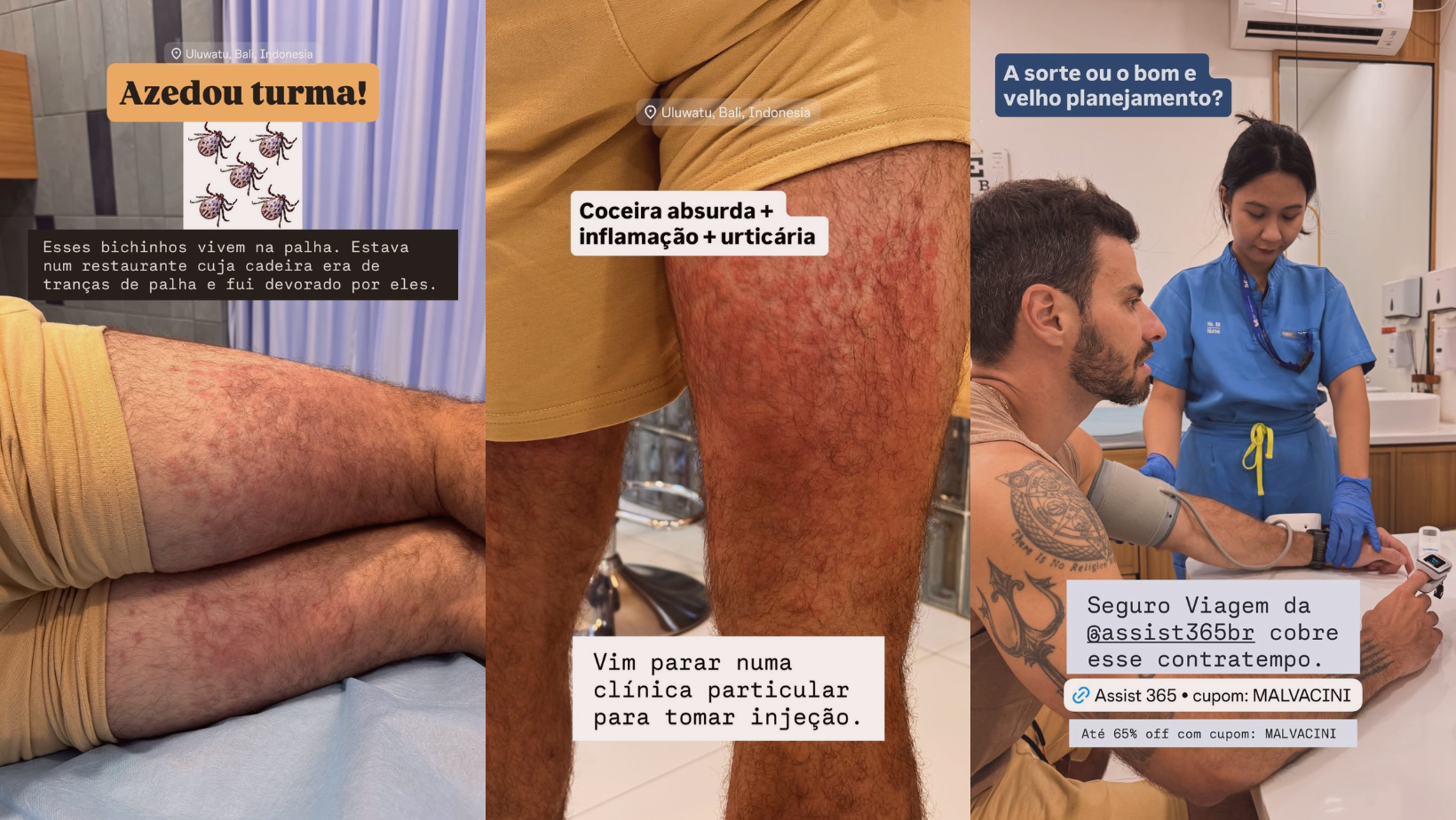 Ex-ator da Globo é hospitalizado após ataque de ácaros na Indonésia