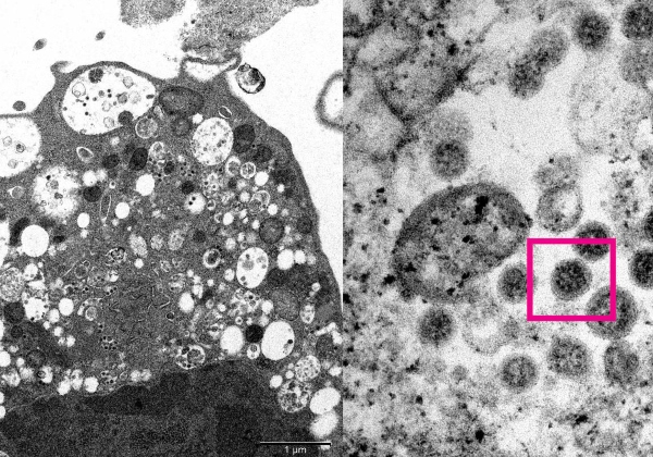 Ômicron é identificada em 31% dos testes coletados na BA e mais 15 estados