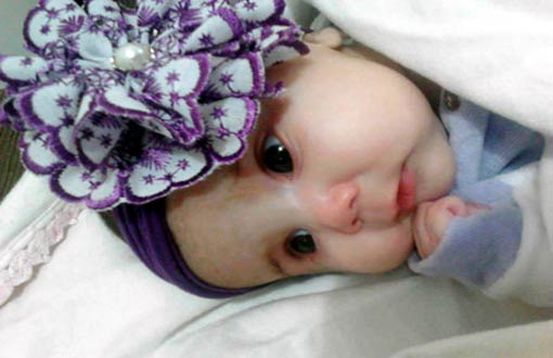 Bebê com síndrome rara consegue vaga hospitalar após decisão judicial
