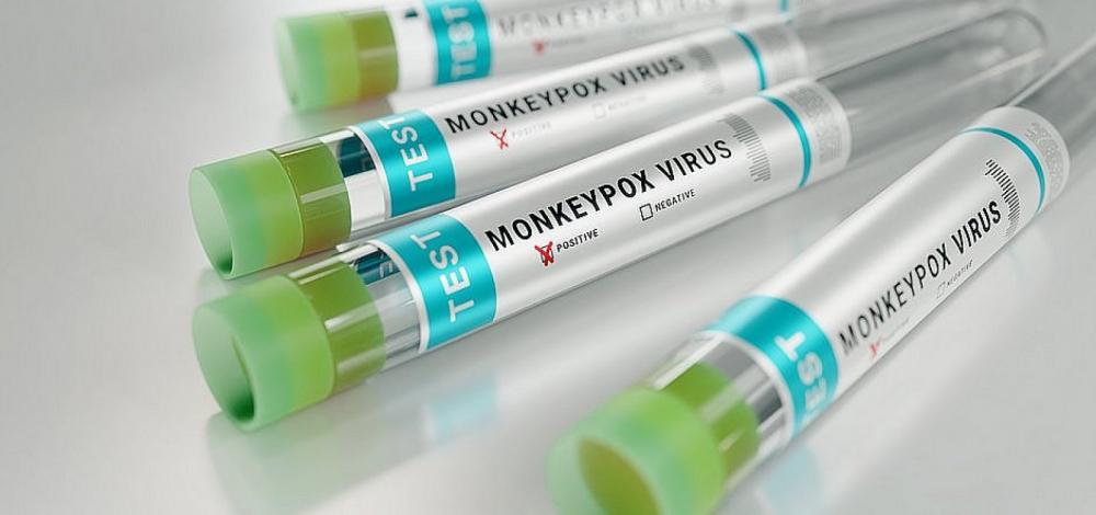 Bahia recebe 412 mil doses de vacinas contra varíola dos macacos