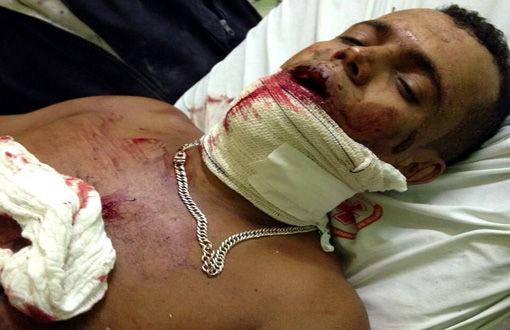 Livramento: homem sofre tentativa de homicídio 