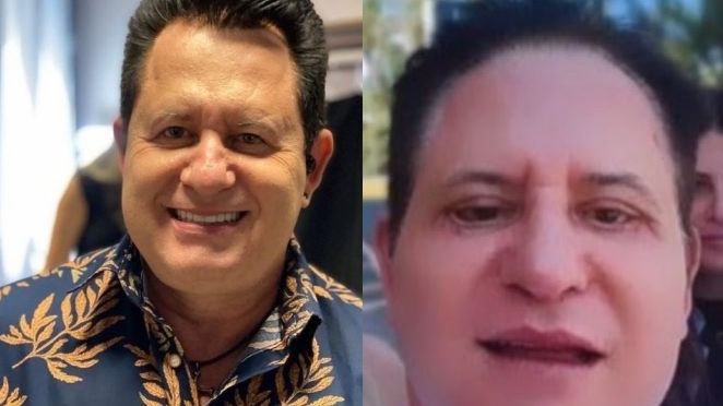 “O que rolou?”; Marrone surge irreconhecível após cirurgia no rosto e mudança ‘assusta’ web