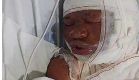 Homem tem corpo queimado após ser torturado em Riacho de Santana