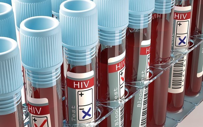 Anvisa aprova novo tratamento para HIV