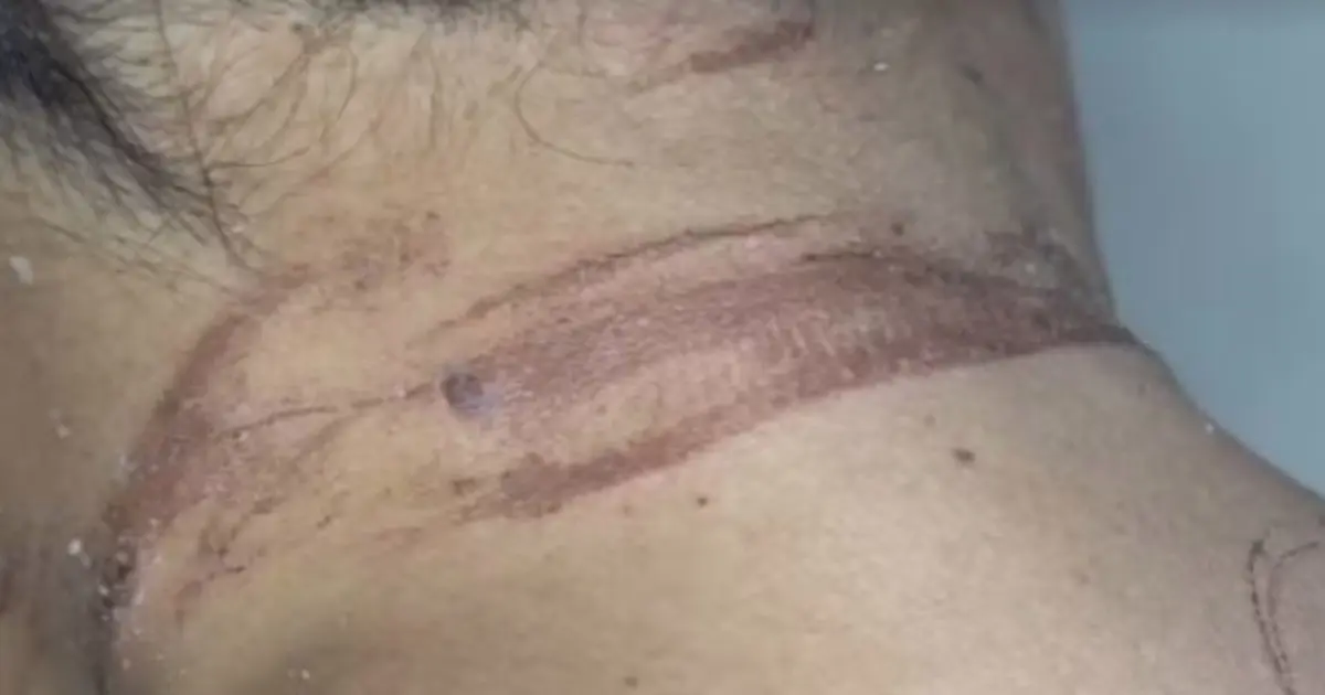 Ex-namorado tenta matar mulher e a enterra viva em Itabuna