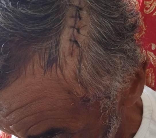 Idoso de 76 anos é espancado a pauladas em Caetité