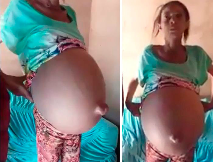 Igaporã: Mulher com 'barriga gigante' morre no Hospital Regional de Guanambi