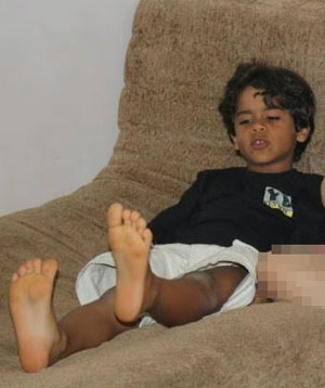 Brumado: Criança morre com suspeita de dengue