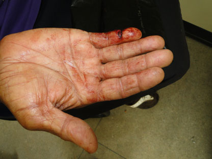 Brumado: Advogado valentão tenta contra companheira