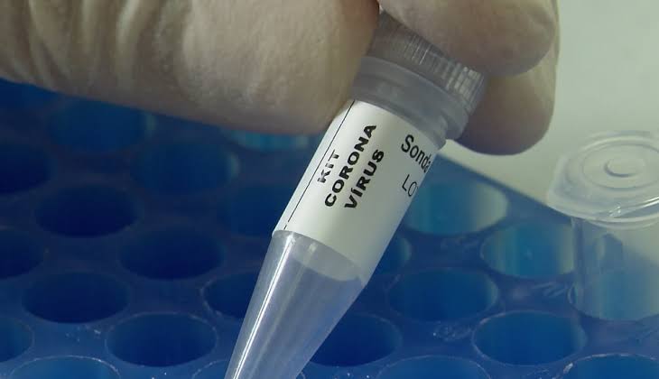 Guanambi não registra casos de coronavírus nas últimas 24 horas 