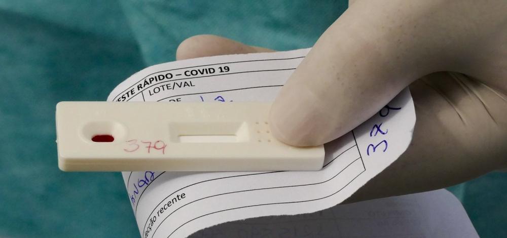 Anvisa aprova realização de testes rápidos de coronavírus em farmácias