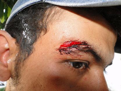 Brumado: jovem é agredido após rejeitar convite para retornar ao antigo emprego.