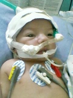 Bebê de Barra da Estiva em estado grave de saúde está internado em Vitória da Conquista