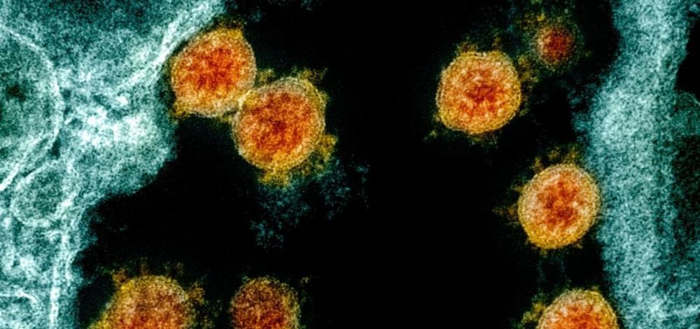 Ômicron corresponde a 98,7% das infecções por Covid no Brasil, indica pesquisa