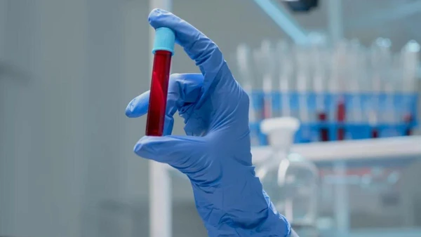 Testemunhas de Jeová flexibilizam regra sobre uso do próprio sangue em cirurgias