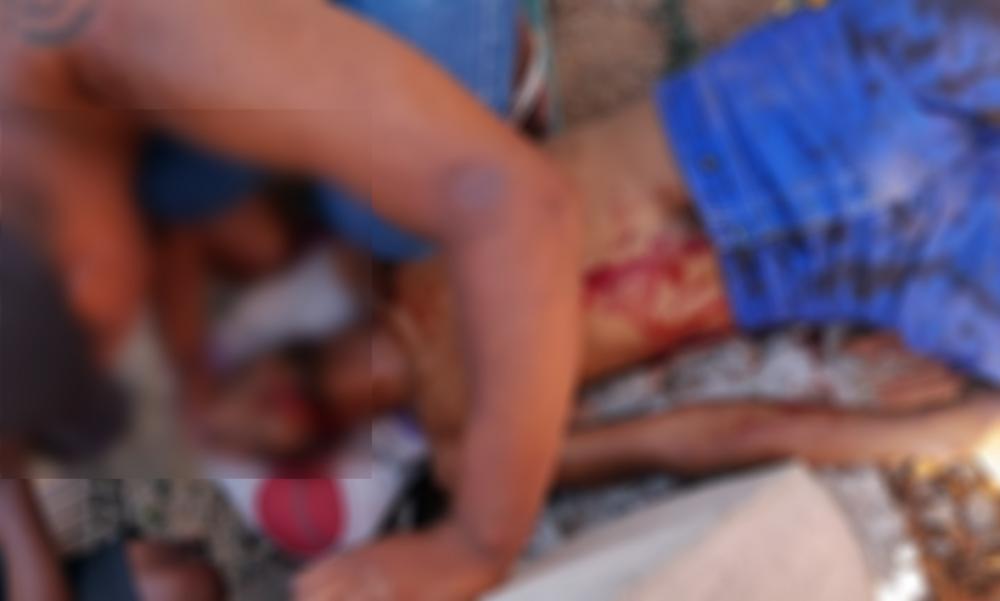 Jovem é socorrido em estado grave após sofrer tentativa de homicídio em Guanambi