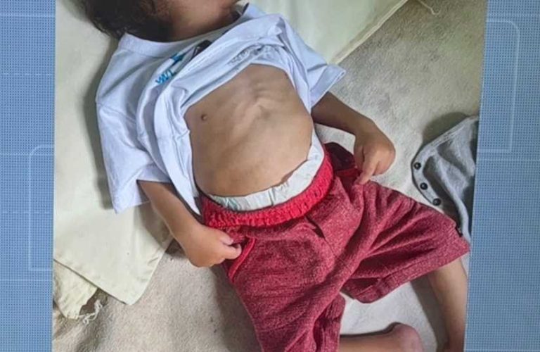 Região: Bebê de um ano e cinco meses morre por desnutrição; pais são presos por maus-tratos