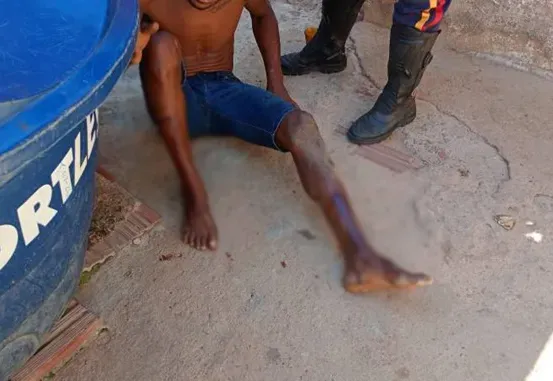 Homem é espancado após tentar defender companheira em Guanambi