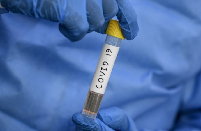 Trabalhadores testam positivo para coronavírus em Licínio de Almeida