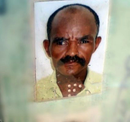 Carinhanha: homem morre após ter cerca de 80% do corpo queimado na zona rural 