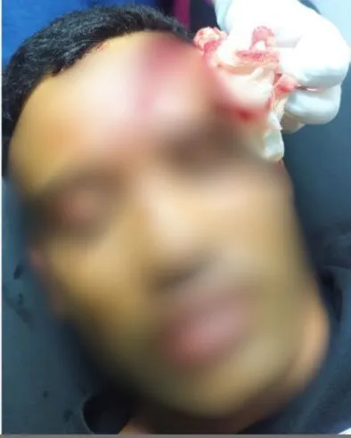 Tribunal do Júri absolve réu de tentativa de homicídio em Igaporã