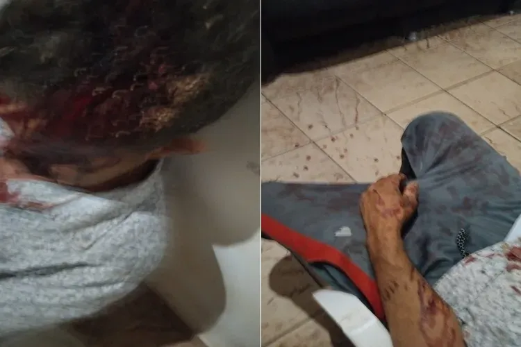Homem fica gravemente ferido após agressão com pedaço de madeira na zona rural de Brumado