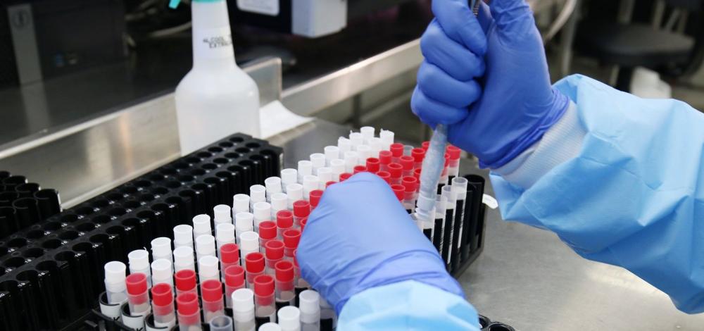 Variante ômicron já concentra 72% dos casos no mundo