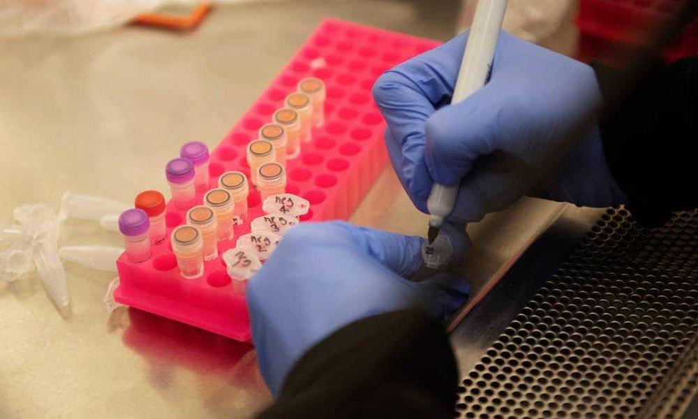 Risco de ataque cardíaco fatal interrompe estudo sobre uso de cloroquina para tratar Covid-19