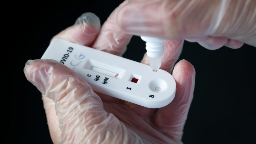 Anvisa libera comercialização de autotestes de Covid-19