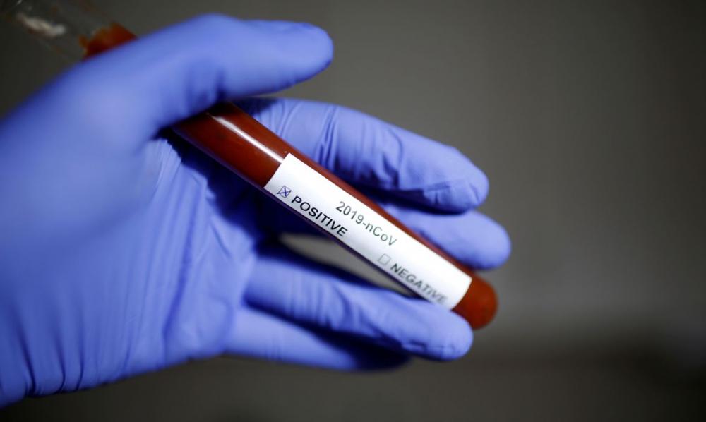 Variantes do coronavírus têm transmissão até 50% mais rápida, diz diretor do Butantan