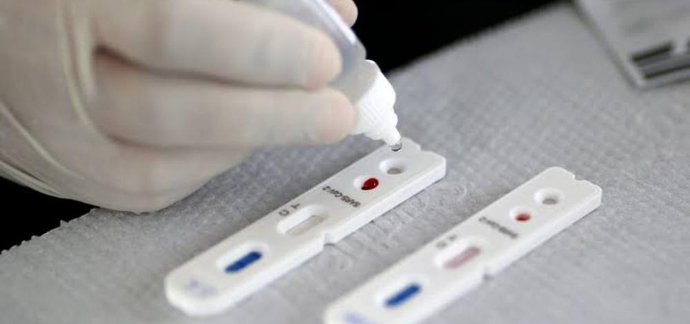 Bahia registra 1.563 novos casos de covid-19 e 57 mortes em 24 horas