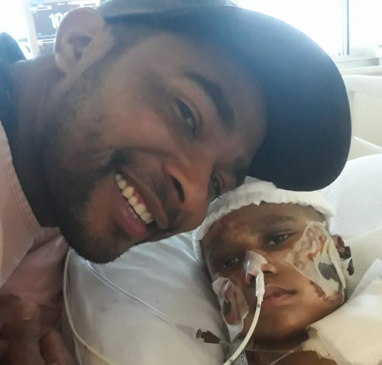 Malhada: imprensa local se une para ajudar família a comprar prótese para criança amputada