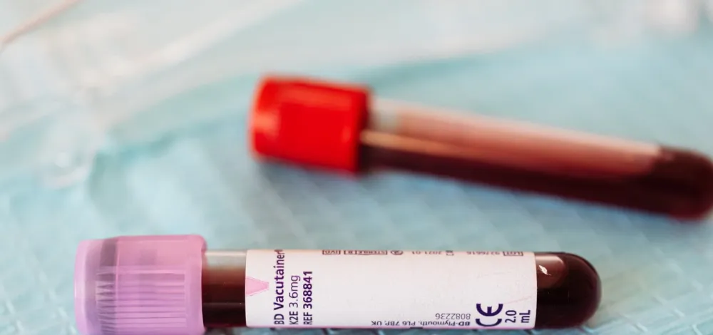 Brasil planeja criar centro nacional para resposta a epidemias e emergências em saúde