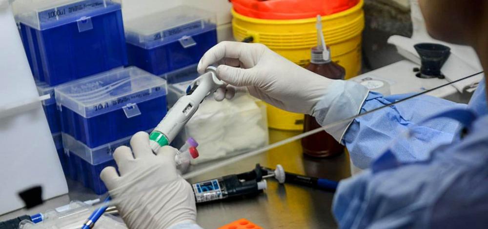 Medicamento contra AIDS tem mais efeito que cloroquina no combate à Covid-19, diz estudo da Fiocruz
