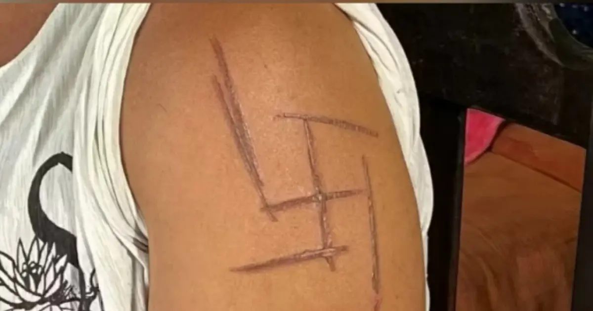 Mulher trans é torturada e marcada com suástica; três são presos