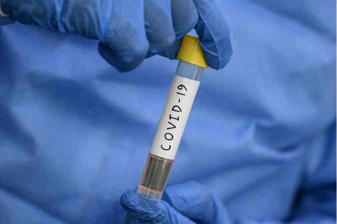 Medicamento usado para piolhos é capaz de matar coronavírus em 48h