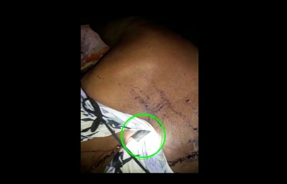Carinhanha: Mulher fica com faca cravada nas costas durante tentativa de homicídio