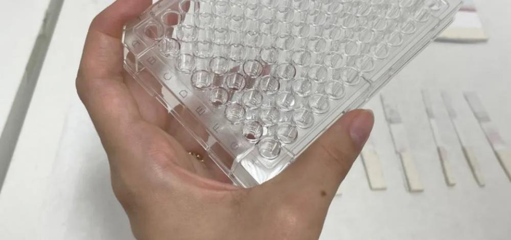 Teste detecta anticorpos da Covid a custo abaixo de R$ 1