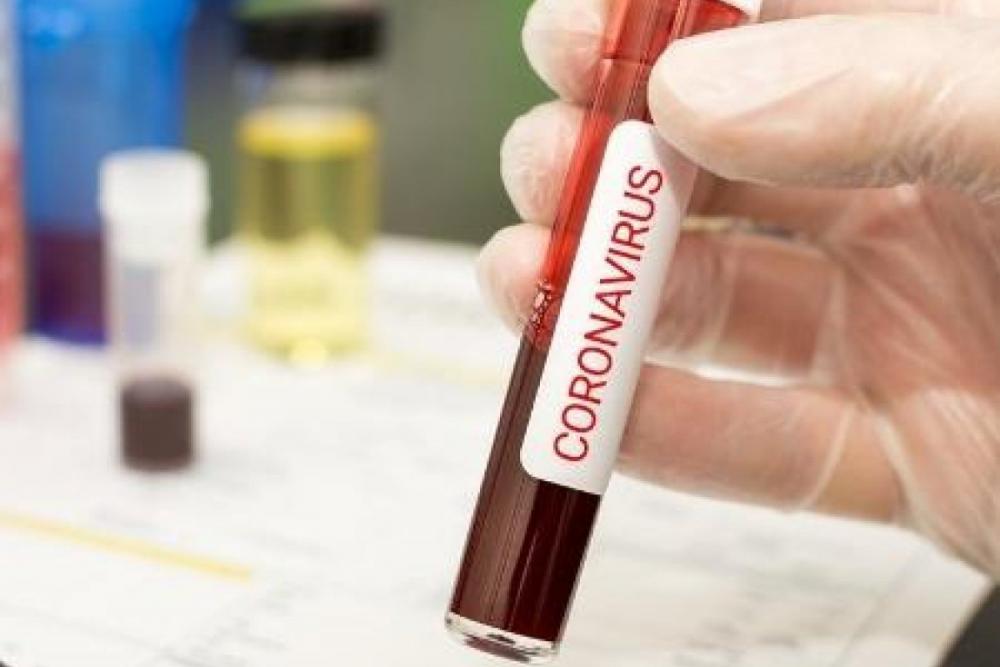 Estado divulga resultado provisório da 1ª etapa do concurso público para professor e coordenador pedagógico