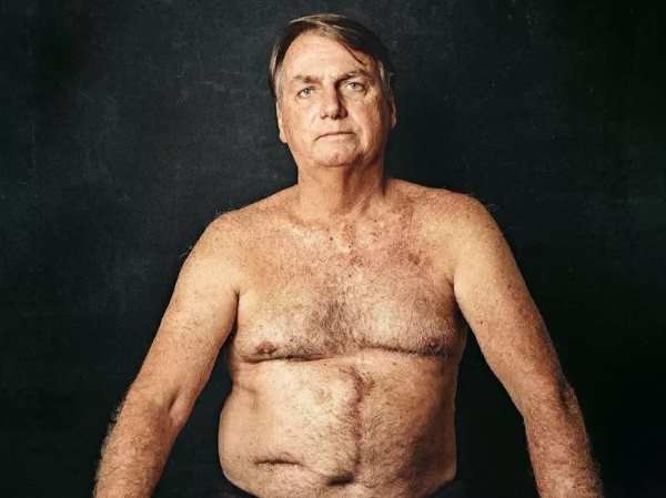Assessor posta foto de Bolsonaro com cicatriz e declara apoio: Vítima dessa tal democracia