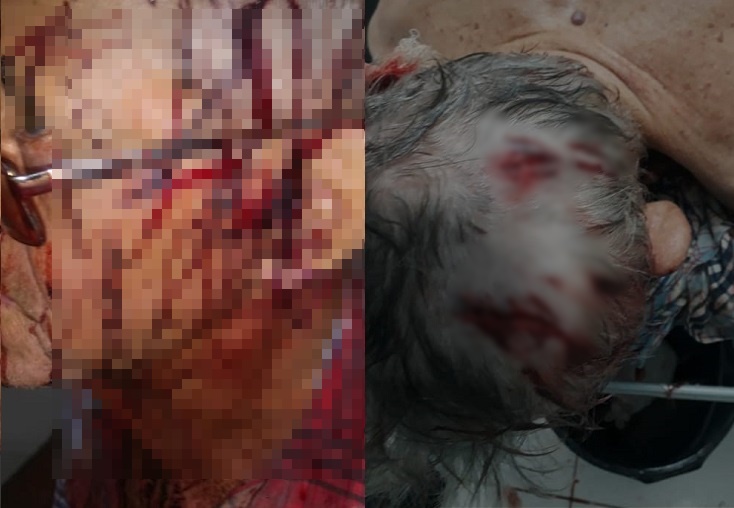 Idosos são amarrados e espancados em assalto na zona rural de Rio do Antônio