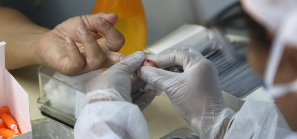 Mundo tem mais de 6 milhões de casos confirmados de Covid-19