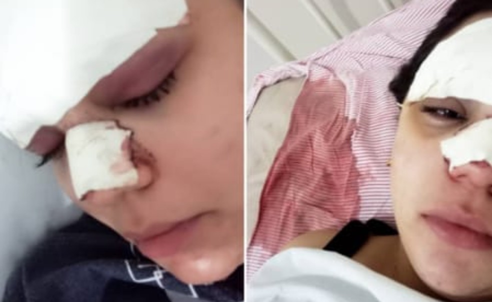 Jovem fica com rosto desfigurado após ser agredida por homem na cidade de Barra da Estiva