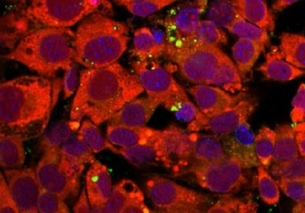 Remédio aprovado pela Anvisa contra o coronavírus chegará ao Brasil em setembro