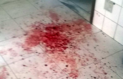 Jussiape : Aluno tenta matar diretora; porteiro fica ferido com golpe de facão